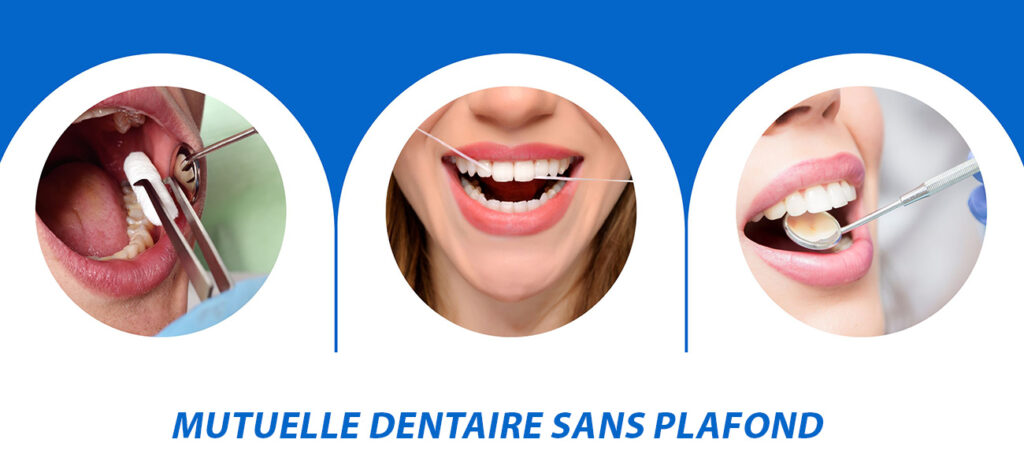 Mutuelle dentaire sans plafond